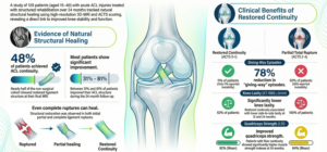 Read more about the article ACL Repair, natural options